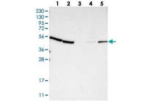 Western blot analysis of Lane 1: RT-4, Lane 2: U-251 MG, Lane 3: Human Plasma, Lane 4: Liver, Lane 5: Tonsil with KLHDC1 polyclonal antibody  at 1:250-1:500 dilution. (KLHDC1 antibody)