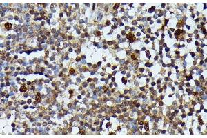 Immunohistochemistry of paraffin-embedded Human appendix using MAP3K3 Polyclonal Antibody at dilution of 1:100 (40x lens). (MAP3K3 antibody)