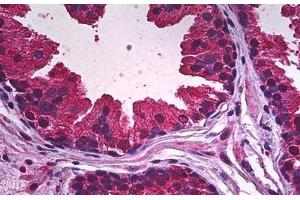 Human Prostate, Epithelium: Formalin-Fixed, Paraffin-Embedded (FFPE) (PDE9A antibody)
