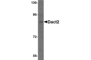 Western blot analysis of Dact2 in SK-N-SH cell lysate with AP30269PU-N Dact2 antibody at 1 μg/ml.