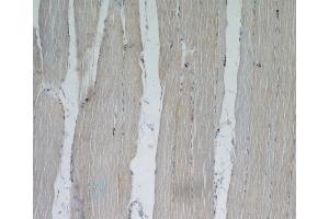 Immunohistochemistry (IHC) image for anti-Xin Actin-Binding Repeat Containing 2 (XIRP2) antibody (ABIN2906145) (XIRP2 antibody)