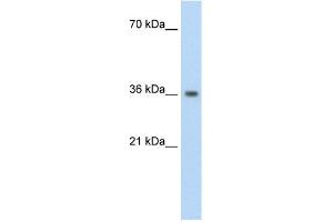 WB Suggested Anti-PHYHIP Antibody Titration:  1.