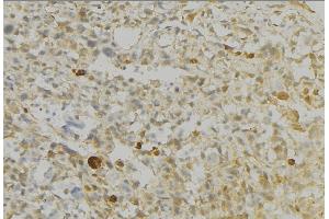 ABIN6276728 at 1/100 staining Human gastric tissue by IHC-P. (Monoamine Oxidase B antibody  (Internal Region))