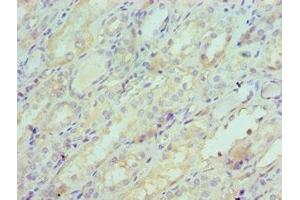 Immunohistochemistry of paraffin-embedded human kidney tissue using ABIN7148620 at dilution of 1:100 (SERPINA6 antibody  (AA 136-405))