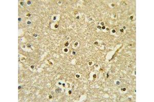 IHC analysis of FFPE human brain tissue stained with PAX6 antibody (PAX6 antibody  (AA 183-210))