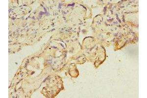 Immunohistochemistry of paraffin-embedded human placenta tissue using ABIN7146710 at dilution of 1:100 (CA13 antibody  (AA 1-262))