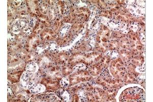 Immunohistochemistry (IHC) analysis of paraffin-embedded Human Kidney, antibody was diluted at 1:100. (M-CSF/CSF1 antibody  (Internal Region))