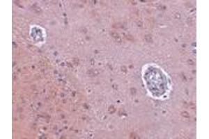 Immunohistochemistry of FAM120A in rat brain tissue with FAM120A antibody at 2. (FAM120A antibody  (Center))