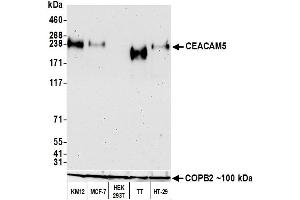 Western Blotting (WB) image for anti-Carcinoembryonic Antigen-Related Cell Adhesion Molecule 5 (CEACAM5) (AA 35-685) antibody (ABIN7453964) (Recombinant CEACAM5 antibody  (AA 35-685))