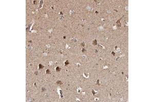 Immunohistochemical staining (Formalin-fixed paraffin-embedded sections) of human cerebral cortex with PRKACB polyclonal antibody  shows strong cytoplasmic positivity in neuronal cells.