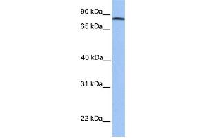 WB Suggested Anti-ADAM7 Antibody Titration: 0. (ADAM7 antibody  (C-Term))