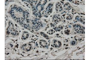 Immunohistochemical staining of paraffin-embedded breast tissue using anti-CD4 mouse monoclonal antibody. (CD4 antibody)