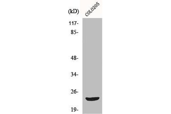MOBKL2B antibody  (Internal Region)