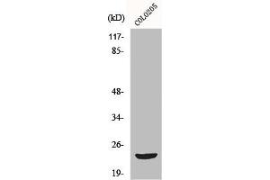 Western Blot analysis of COLO205 cells using Mob3B Polyclonal Antibody (MOBKL2B antibody  (Internal Region))