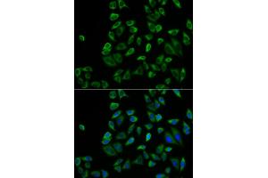 Immunofluorescence analysis of HeLa cells using PEX5 antibody (ABIN5973402). (PEX5 antibody)