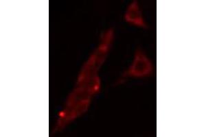 ABIN6268691 staining HeLa cells by IF/ICC. (TJP1 antibody)