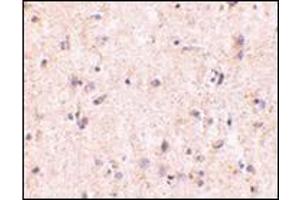 Immunohistochemistry of IRGM in human brain with this product at 5 μg/ml. (IRGM antibody  (Center))