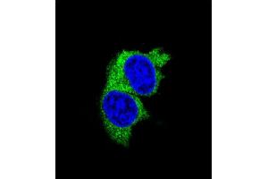 Confocal iunofluorescent analysis of P1 Antibody (Center) (ABIN655817 and ABIN2845241) with MDA-M cell followed by Alexa Fluor 488-conjugated goat anti-rabbit lgG (green). (MMP1 antibody  (AA 317-347))
