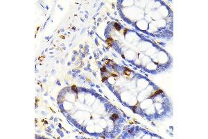 Immunohistochemistry of paraffin-embedded human colon using Secretagogin (Secretagogin (SCGN)) Rabbit mAb (ABIN7270178) at dilution of 1:100 (40x lens). (SCGN antibody)