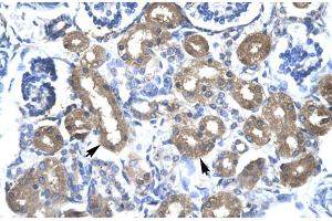 Rabbit Anti-CBX 4 Antibody Catalog Number: ARP30002 Paraffin Embedded Tissue: Human Kidney Cellular Data: Epithelial cells of renal tubule Antibody Concentration: 4. (CBX4 antibody  (N-Term))
