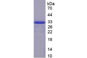 SDS-PAGE of Protein Standard from the Kit (Highly purified E. (Prothrombin ELISA Kit)