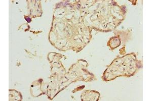 Immunohistochemistry of paraffin-embedded human placenta tissue using ABIN7173063 at dilution of 1:100 (TMEM143 antibody  (AA 8-278))