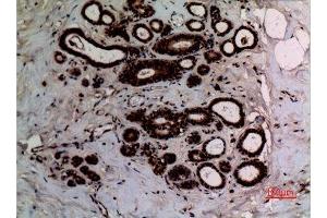 Immunohistochemistry (IHC) image for anti-X-Ray Repair Complementing Defective Repair in Chinese Hamster Cells 6 (XRCC6) (acLys542) antibody (ABIN3181890)