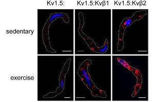 Representative proximity ligation images showing positive sites of interaction (red) between Kv1.
