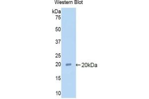 Detection of Recombinant a2PI, Rat using Polyclonal Antibody to Alpha 2-Antiplasmin (a2PI) (alpha 2 Antiplasmin antibody  (AA 348-491))