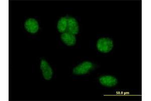 Immunofluorescence of purified MaxPab antibody to C1orf181 on HeLa cell. (ZNHIT6 antibody  (AA 1-470))