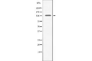 Western blot analysis of extracts from HeLa cells using AMPD2 antibody. (AMPD2 antibody  (N-Term))