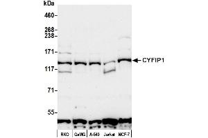 anti-Cytoplasmic FMR1 Interacting Protein 1 (CYFIP1) (AA 1203-1253) antibody