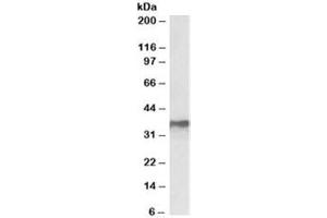 Western blot testing of MCF7 lysate with HNRNPA2B1 antibody at 0. (HNRNPA2B1 antibody)