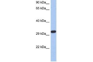 CAPZA3 antibody used at 1 ug/ml to detect target protein.