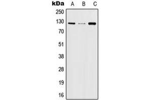 Western blot analysis of JAK2 (pY570) expression in HeLa (A), TF1 (B), NIH3T3 (C), rat kidney (D) whole cell lysates. (JAK2 antibody  (pTyr570))