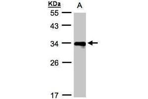 WB Image Sample(30 ug whole cell lysate) A:Raji , 12% SDS PAGE antibody diluted at 1:1000 (HLA-DRB4 antibody  (Center))