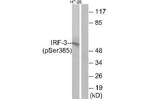 Immunohistochemistry analysis of paraffin-embedded human colon carcinoma tissue using IRF-3 (Phospho-Ser385) antibody.