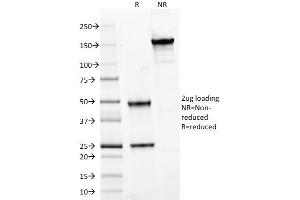 SDS-PAGE Analysis Purified PAX7 Mouse Monoclonal Antibody (PAX7/497). (PAX7 antibody  (AA 301-505))