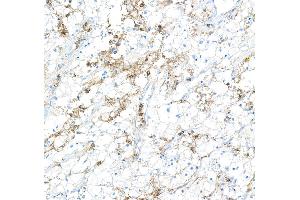 Immunohistochemistry (IHC) image for anti-CD16 (CD16) (AA 21-201) antibody (ABIN7449423) (Recombinant CD16 antibody  (AA 21-201))
