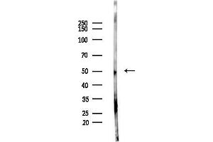 Western blot analysis of lysates from LoVo cells(heat-shock,45 min treatment), using Phospho-IRF3 (Ser386) Antibody at 1/1000 dilution.