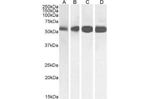 Western Blot using anti-Beta-Tubulin antibody S11B. (Recombinant TUBB antibody)