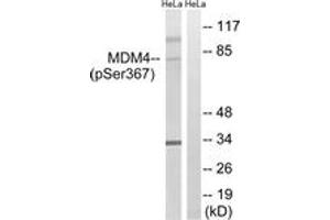 Western blot analysis of extracts from HeLa cells treated with calyculinA 50ng/ml 30', using MDM4 (Phospho-Ser367) Antibody. (MDM4-binding Protein antibody  (pSer367))