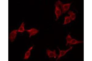 ABIN6275259 staining LOVO by IF/ICC. (MNDA antibody  (Internal Region))
