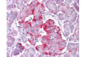 Immunohistochemistry (IHC) image for anti-Signal Transducer and Activator of Transcription 1, 91kDa (STAT1) (N-Term) antibody (ABIN2780843) (STAT1 antibody  (N-Term))