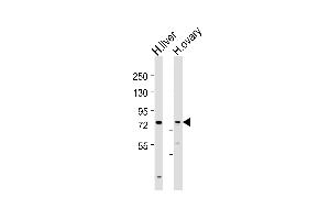 Western Blot at 1:2000 dilution Lane 1: human liver lysates Lane 2: human ovary lysates Lysates/proteins at 20 ug per lane. (SLCO1B3 antibody  (C-Term))