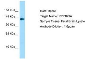 Image no. 1 for anti-Protein Phosphatase 1, Regulatory (Inhibitor) Subunit 9A (PPP1R9A) (C-Term) antibody (ABIN6750130) (PPP1R9A antibody  (C-Term))