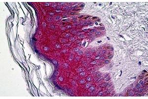 Anti-Gamma Catenin antibody IHC staining of human skin.