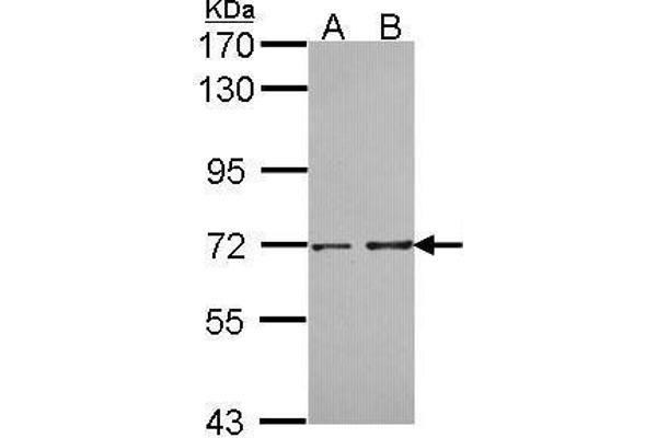 PPP2R5D Antikörper  (C-Term)