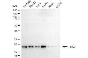 Western blotting analysis using HRAS antibody (ABIN7799000). (HRAS antibody)