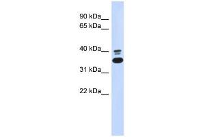 WB Suggested Anti-ABHD7 Antibody Titration: 0. (EPHX4 antibody  (N-Term))